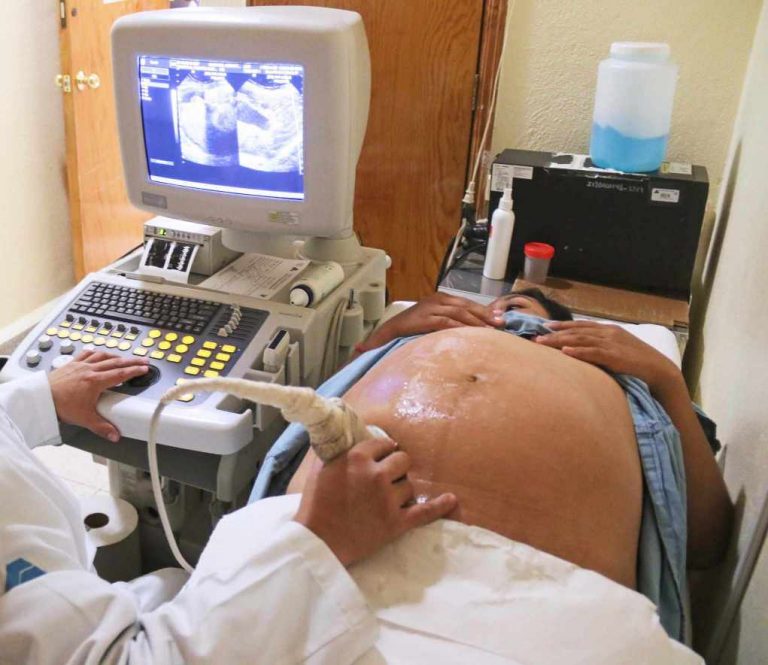 EMBARAZO ADOLESCENTE (1) (1)