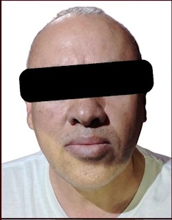 DETENIDO